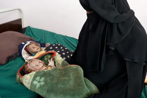 Lee Durant/BBC Raad Hassan is held by his mother Lina, as his twin sister Raghad lies beside him on a bed at a hospital in Aden, Yemen